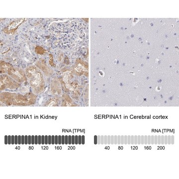 Anti-SERPINA1 antibody produced in rabbit Prestige Antibodies&#174; Powered by Atlas Antibodies, affinity isolated antibody, buffered aqueous glycerol solution