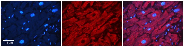 Anti-ATXN2 antibody produced in rabbit affinity isolated antibody