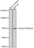 Anti-TNFR2/TNFRSF1B Antibody, clone 7S1K0, Rabbit Monoclonal