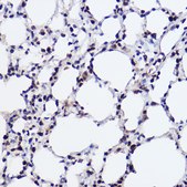 Anti-GTF2I Antibody, clone 5B6D1, Rabbit Monoclonal