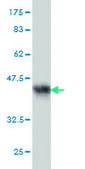 Monoclonal Anti-PCDH1 antibody produced in mouse clone 5D5, purified immunoglobulin, buffered aqueous solution