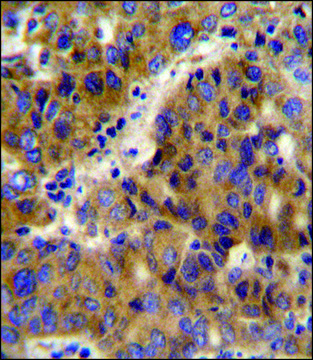 ANTI-BCKDHB (N-TERM) antibody produced in rabbit IgG fraction of antiserum, buffered aqueous solution