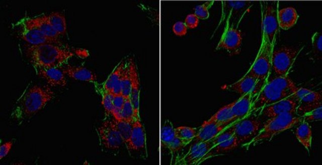 Anti-Laminin Receptor Antibody from rabbit, purified by affinity chromatography