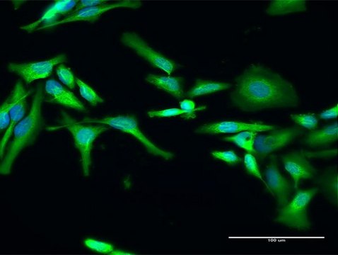 Anti-RELT antibody produced in rabbit purified immunoglobulin, buffered aqueous solution