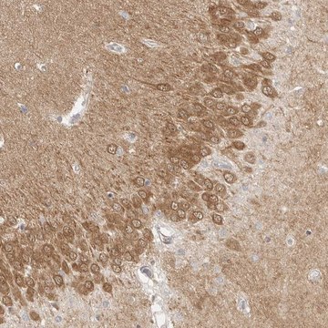 Anti-MAP2K1 antibody produced in rabbit Prestige Antibodies&#174; Powered by Atlas Antibodies, affinity isolated antibody, buffered aqueous glycerol solution