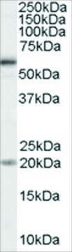 Anti-BMPR1A antibody produced in goat affinity isolated antibody, buffered aqueous solution