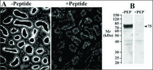 Anti-Slc5a1 antibody produced in goat affinity isolated antibody, buffered aqueous solution