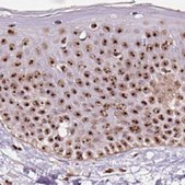 Anti-GNL3 antibody produced in rabbit Prestige Antibodies® Powered by Atlas Antibodies, affinity isolated antibody, buffered aqueous glycerol solution