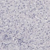 Anti-NEK9 antibody produced in rabbit Prestige Antibodies® Powered by Atlas Antibodies, affinity isolated antibody, buffered aqueous glycerol solution