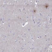 Anti-PCSK1N antibody produced in rabbit Prestige Antibodies® Powered by Atlas Antibodies, affinity isolated antibody, buffered aqueous glycerol solution