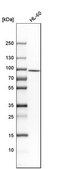 Anti-RNASEL antibody produced in rabbit Prestige Antibodies® Powered by Atlas Antibodies, affinity isolated antibody, buffered aqueous glycerol solution