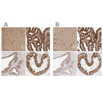 Anti-NUDC antibody produced in rabbit Prestige Antibodies&#174; Powered by Atlas Antibodies, affinity isolated antibody, buffered aqueous glycerol solution, ab1