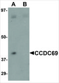 Anti-CCDC69 antibody produced in chicken affinity isolated antibody, buffered aqueous solution
