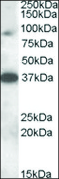 Anti-MARCH10 antibody produced in goat affinity isolated antibody, buffered aqueous solution