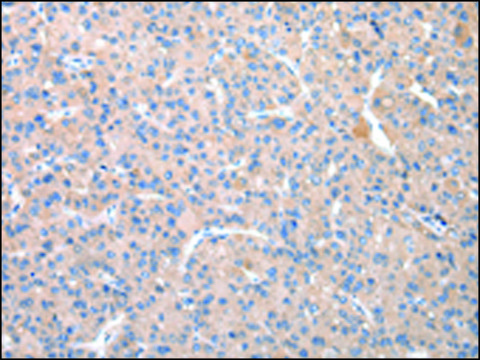 Anti-TCN2 affinity isolated antibody