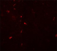 Anti-C1orf187 antibody produced in rabbit affinity isolated antibody