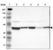 Anti-AHSA1 antibody produced in rabbit Prestige Antibodies® Powered by Atlas Antibodies, affinity isolated antibody, buffered aqueous glycerol solution