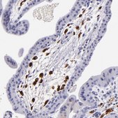 Anti-F13A1 antibody produced in rabbit Prestige Antibodies&#174; Powered by Atlas Antibodies, affinity isolated antibody, buffered aqueous glycerol solution