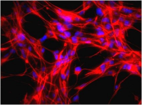 Anti-Nestin Antibody, clone rat-401, Cy3 conjugate clone rat-401, from mouse, CY3 conjugate