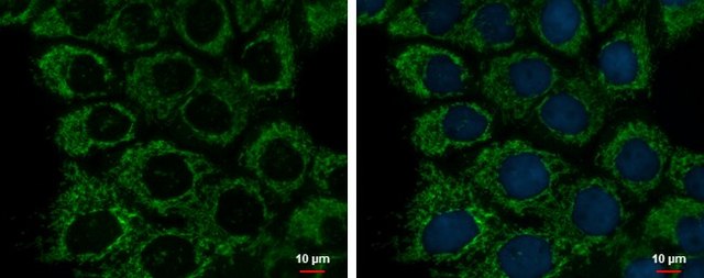 Monoclonal Anti-ETHE1 antibody produced in mouse clone GT1621, affinity isolated antibody