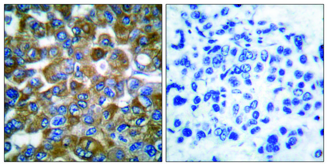 Anti-Keratin 15 antibody produced in rabbit affinity isolated antibody