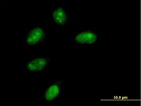 Anti-NMNAT1 antibody produced in mouse purified immunoglobulin, buffered aqueous solution