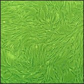 Bovine Renal Artery Smooth Muscle Cells: BRASMC (Cryovial)