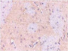 Anti-GPAT-1 Antibody from rabbit, purified by affinity chromatography