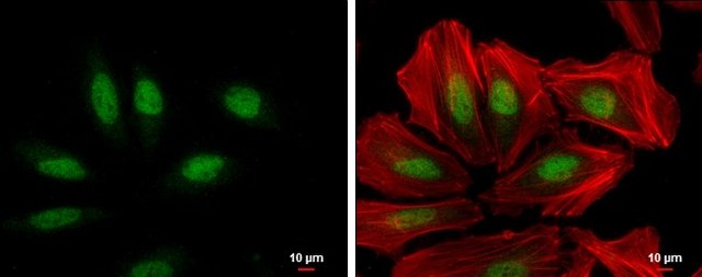 Monoclonal Anti-XPC antibody produced in mouse