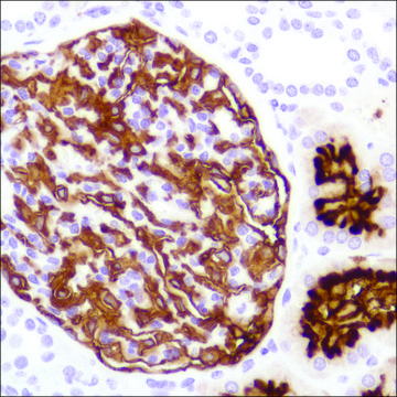 Anti-CD10 antibody, Rabbit monoclonal recombinant, expressed in proprietary host, clone SP179, affinity isolated antibody