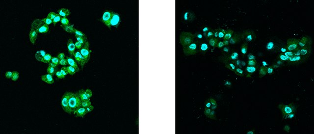 BioTracker&#8482; Putrescine Polyamine Green Fluorescent Live Cell Probe