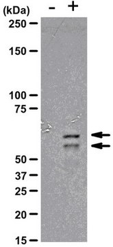 Anti-phospho-PPAR&#947; (Ser82) Antibody, clone AW504, rabbit monoclonal clone AW504, from rabbit