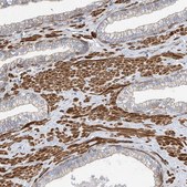 Anti-SLC43A3 antibody produced in rabbit Prestige Antibodies® Powered by Atlas Antibodies, affinity isolated antibody, buffered aqueous glycerol solution