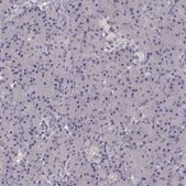Anti-SLC22A18 antibody produced in rabbit Prestige Antibodies® Powered by Atlas Antibodies, affinity isolated antibody