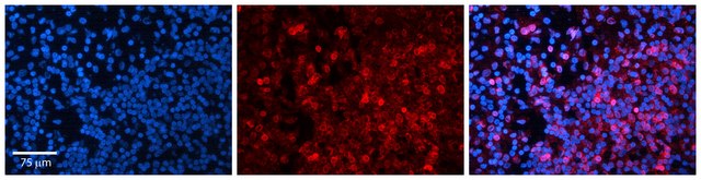 Anti-MYC, (N-terminal) antibody produced in rabbit affinity isolated antibody