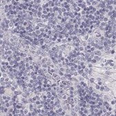 Anti-KRT25 antibody produced in rabbit Prestige Antibodies® Powered by Atlas Antibodies, affinity isolated antibody, buffered aqueous glycerol solution