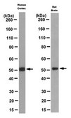 Anti-FOXG1 Antibody, clone 3G11.2 clone 3G11.2, from mouse
