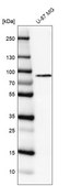 Anti-PLOD1 antibody produced in rabbit Prestige Antibodies® Powered by Atlas Antibodies, affinity isolated antibody, buffered aqueous glycerol solution