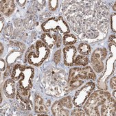 Anti-PPP1R7 antibody produced in rabbit Prestige Antibodies® Powered by Atlas Antibodies, affinity isolated antibody, buffered aqueous glycerol solution