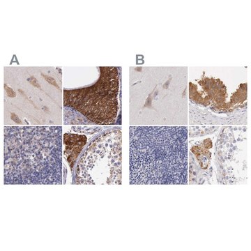 Anti-NSDHL antibody produced in rabbit Ab2, Prestige Antibodies&#174; Powered by Atlas Antibodies, affinity isolated antibody, buffered aqueous glycerol solution