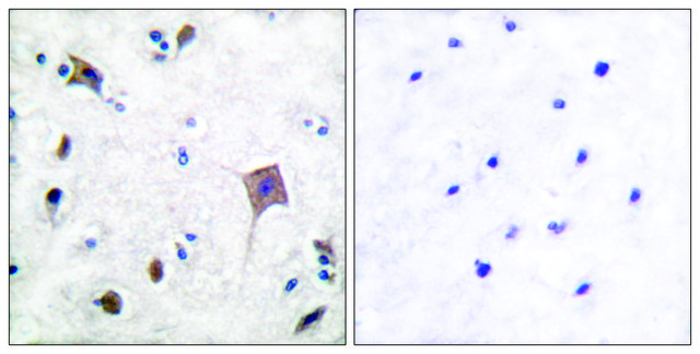 Anti-PYK2 antibody produced in rabbit affinity isolated antibody