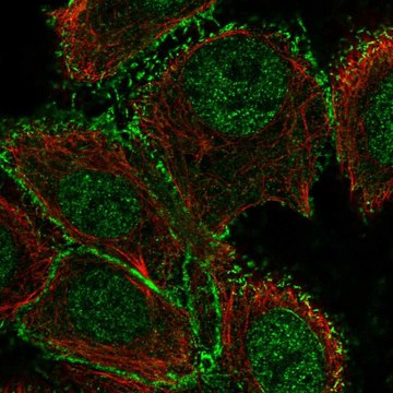 Anti-Galnt12 Antibody Produced In Rabbit Prestige Antibodies&#174; Powered by Atlas Antibodies, affinity isolated antibody, buffered aqueous glycerol solution