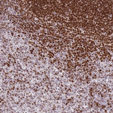 Anti-SP110 antibody produced in rabbit Prestige Antibodies&#174; Powered by Atlas Antibodies, affinity isolated antibody, buffered aqueous glycerol solution