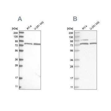 Anti-P2RX7 antibody produced in rabbit Prestige Antibodies&#174; Powered by Atlas Antibodies, affinity isolated antibody, buffered aqueous glycerol solution