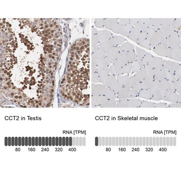 Anti-CCT2 antibody produced in rabbit Ab2, Prestige Antibodies&#174; Powered by Atlas Antibodies, affinity isolated antibody, buffered aqueous glycerol solution