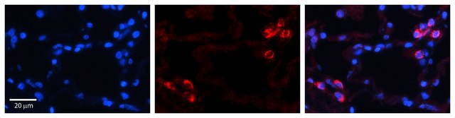 抗-IGFBP7 兔抗 affinity isolated antibody