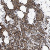 Anti-MARC2 antibody produced in rabbit Prestige Antibodies® Powered by Atlas Antibodies, affinity isolated antibody, buffered aqueous glycerol solution