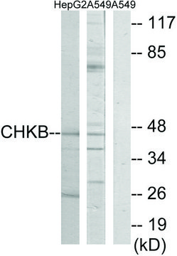 Anti-CHKB antibody produced in rabbit affinity isolated antibody