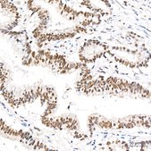 Anti-UBE2B Antibody, clone 2Z3R2, Rabbit Monoclonal