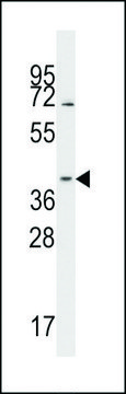 ANTI-HSP40 antibody produced in rabbit IgG fraction of antiserum, buffered aqueous solution